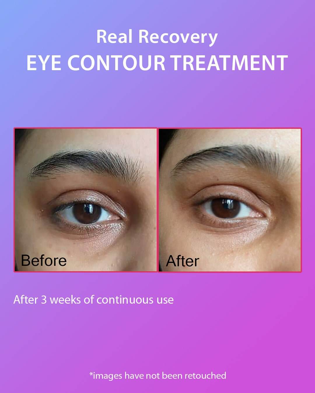 Magic Wand Eye Contour Treatment