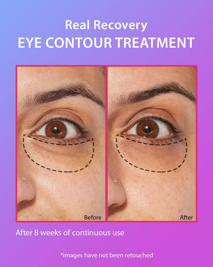 Magic Wand Eye Contour Treatment