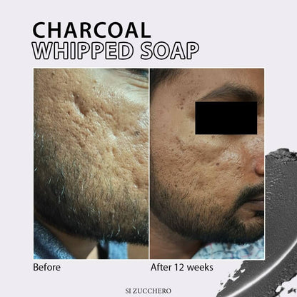 Charcoal whipped soap results